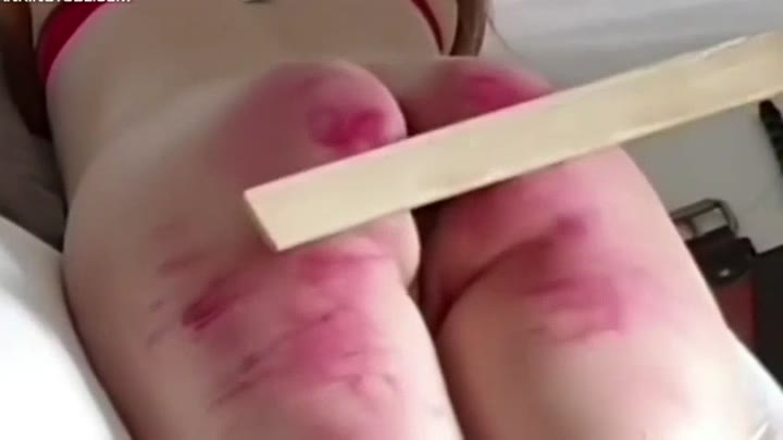 Hard Paddle Causing Bruising